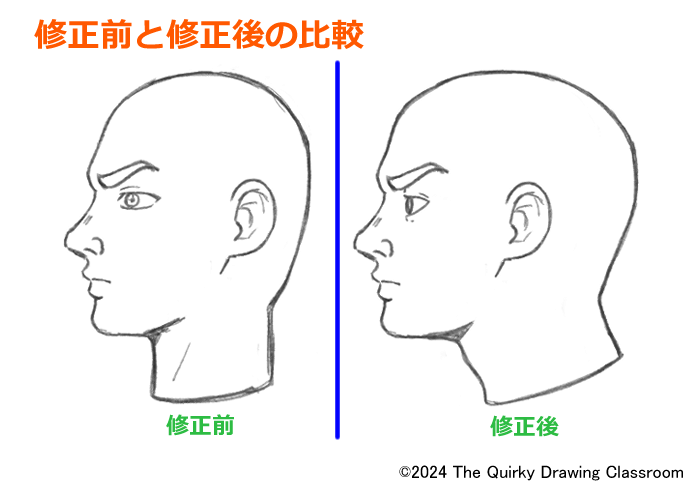 修正前と修正後の横顔の比較